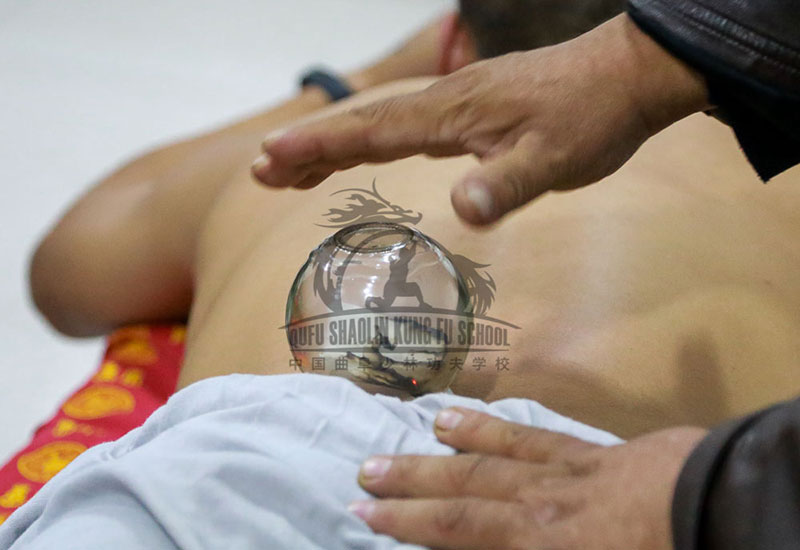 Cupping therapy