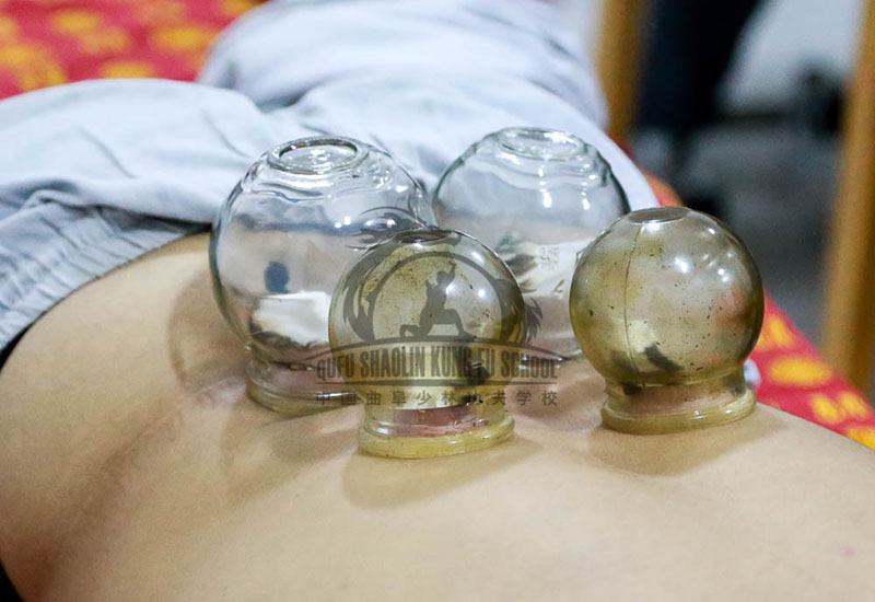 learning Cupping therapy